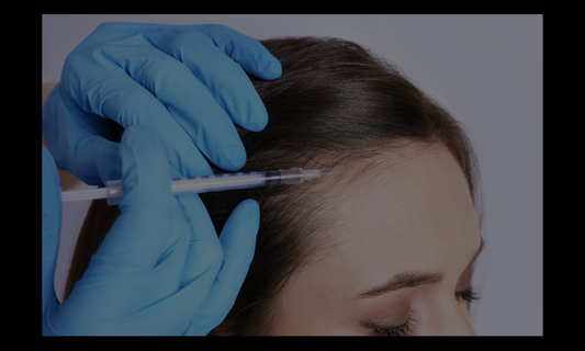 PRP - HAIR RESTORATION